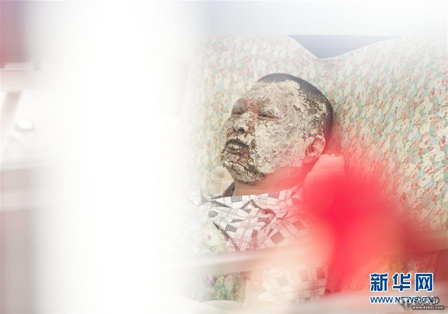 （中国网事·感动人物·图文互动）（2）“炸弹”引爆瞬间，他用胸膛堵了上去——湖北“扑爆哥”为救人用身体压住“炸弹” 